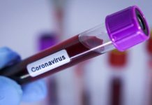 Coronavírus já mata 1 a cada 2h20 no Estado de SP