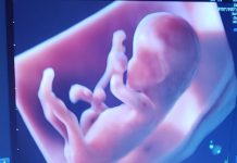 Ultrassom 5D traz inovação na saúde de gestantes e bebês