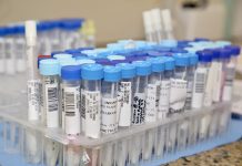 SP ultrapassa 2,5 milhões de casos de COVID-19 e registra 76,5 mil óbitos