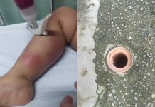 Bebê de 1 ano tem infecção na perna após cair em esgoto no litoral, diz mãe