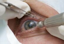 Pandemia faz cair detecção precoce de glaucoma