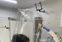 Santa Casa ganha capacetes respiradores para pacientes COVID-19