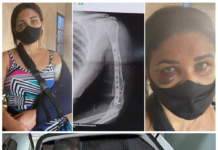 Advogada de homem que agrediu funcionária após briga por máscara diz que prisão foi caso excepcional