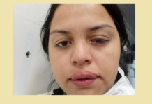 POLÍCIA Ex-patrão que jogou ácido no rosto da ex-funcionária se apresenta à polícia