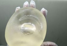 Inmetro orienta sobre implantes mamários com certificação suspensa