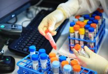 Casos da variante Delta crescem 84% em uma semana no Brasil