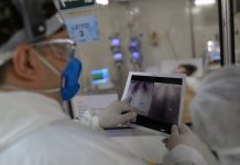 Brasil acumula 20 milhões de casos de Covid-19 e 563 mil óbitos