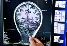 OMS: demência deverá afetar 139 milhões de pessoas em 2050