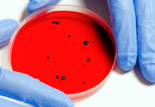 Monitoramento de vírus, fungos e bactérias poderá evitar novas pandemias