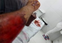 Motorista que atropelou policial militar após fugir de abordagem é preso em Bilac