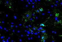 Vírus da Covid usa mais energia de células do cérebro para se replicar