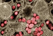 Ômicron: conheça os cinco sintomas da nova variante do coronavírus