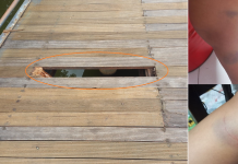 Jovem sofre ferimentos após deck de madeira quebrar no Parque da Cultura