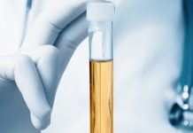 Verão aumenta risco de infecção urinária, mas uma dica simples pode evitar a doença