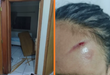 Mulher fica ferida após ser agredida pelo filho com tábua de passar roupas em Rio Preto