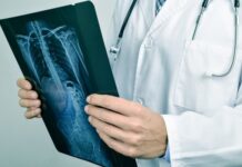Abril Amarelo mostra a médicos melhor conduta para tratar câncer ósseo