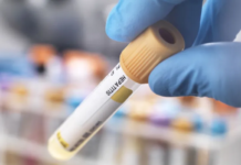 Saúde investiga nove casos de hepatite aguda infantil no Brasil
