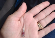 Sindicância para investigar denúncia de mãe após agulha ficar presa na filha em injeção é arquivada em Penápolis