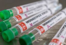 Anvisa orienta hospitais sobre casos de varíola dos macacos