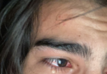 Digital Influencer Ally Alexandrino relata homofobia em escola: “Pensei em suicídio”