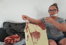 Motociclista fica ferida ao ser atingida por linha com cerol em rodovia Araçatuba