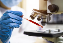 Cientistas brasileiras desenvolvem método que detecta câncer de mama pelo sangue