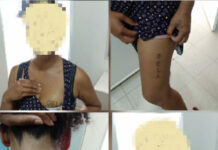 Vítima de violência doméstica é obrigada a tatuar o nome do marido pelo corpo