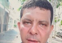 Homem segue internado após explosão de churrasqueira em Votuporanga