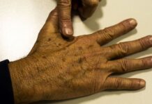 Brasil terá 704 mil novos casos de câncer por ano até 2025, diz Inca