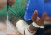 Idoso tem perna amputada após ser atacado por cães em Severínia