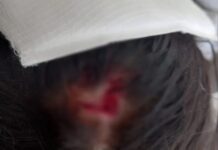 Adolescente de 13 anos é agredida com golpes de martelo em sala de aula