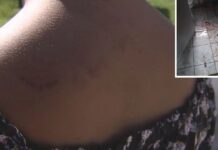 Justiça determina que homem acusado de agredir companheira a marretadas seja internado em hospital psiquiátrico