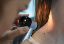 Junho Preto: mês de combate ao melanoma
