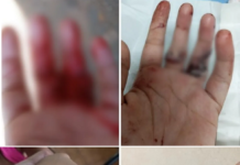 Polícia investiga motorista por aplicativo suspeito de agredir adolescente com facão em Rio Preto