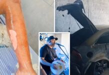 Pagodeiro se recupera de queimaduras ao ficar preso em carro em chamas após tanque de gasolina explodir: ‘Grato pela vida’