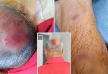 Aposentado é socorrido com ferimentos após ser atacado por cachorros