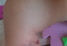 Polícia investiga queimaduras em perna e partes íntimas de bebê em creche