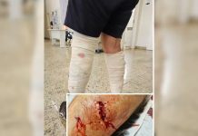 Idoso fica ferido ao ser atacado por cães em Rio preto