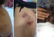 Crianças ficam feridas após serem atacadas por pit bulls em Rio Preto