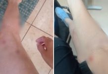 Enfermeira fica ferida após ser derrubada de moto e atacada por cães em semáforo