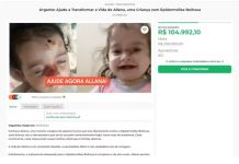 Polícia investiga suspeitos de usarem fotos de criança com doença rara para arrecadar dinheiro