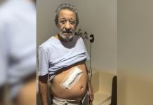 Funcionários são advertidos por hospital após idoso com hemorroida ser operado da vesícula