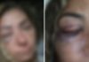 Mulher é agredida por segurança e dono de bar em Rio Preto