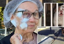 Idosa leva 50 pontos no rosto após ser atacada por pit bull