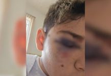 Estudante leva três pontos no rosto após ser agredido por um colega de sala dentro de escola