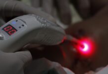 Laserterapia é aliada no tratamento de feridas em mães e bebês no HCM de Rio Preto