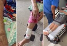 Idosa é atacada por cão que estava solto em rua de Riolândia