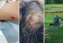 Criança de 4 anos sofre ferimentos na cabeça e na perna após ser atacada por cão