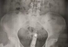 Agentes apreendem celulares escondidos em órgão genital de mulher durante visita a presídio