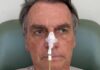 Bolsonaro come gelatina, mantém movimentos intestinais e segue estável na UTI